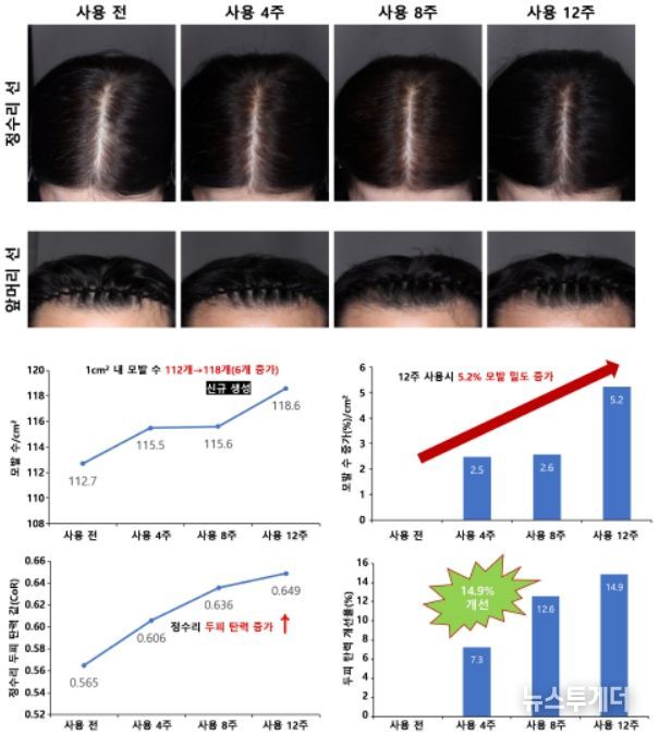 모발 밀도와 두피 탄력 개선